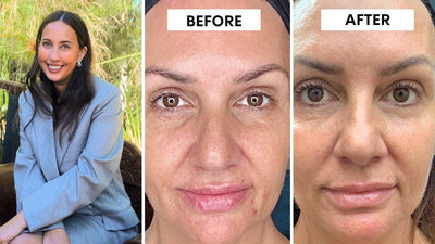 HerVitals Magnesium Gummies