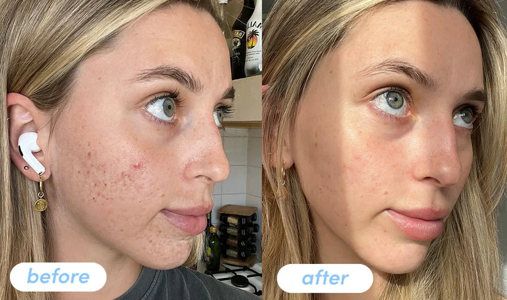 Multi Collagen Peptides Powder